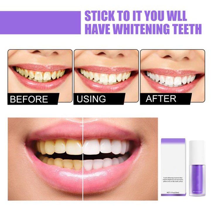 🔥48% OFF🔥Teeth Colour Corrector Serum